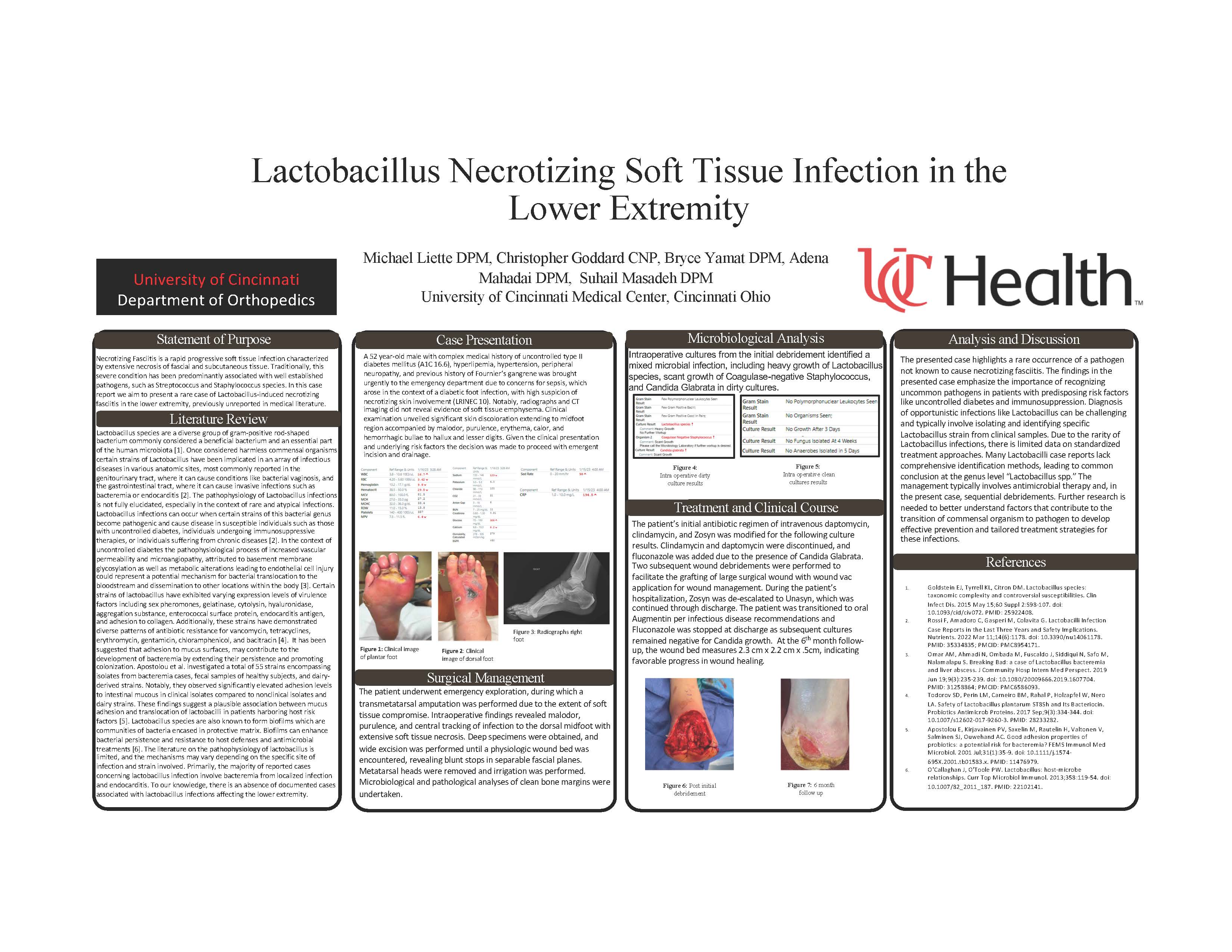 Lactobacillus Necrotizing Soft Tissue Infection in the Lower Extremity